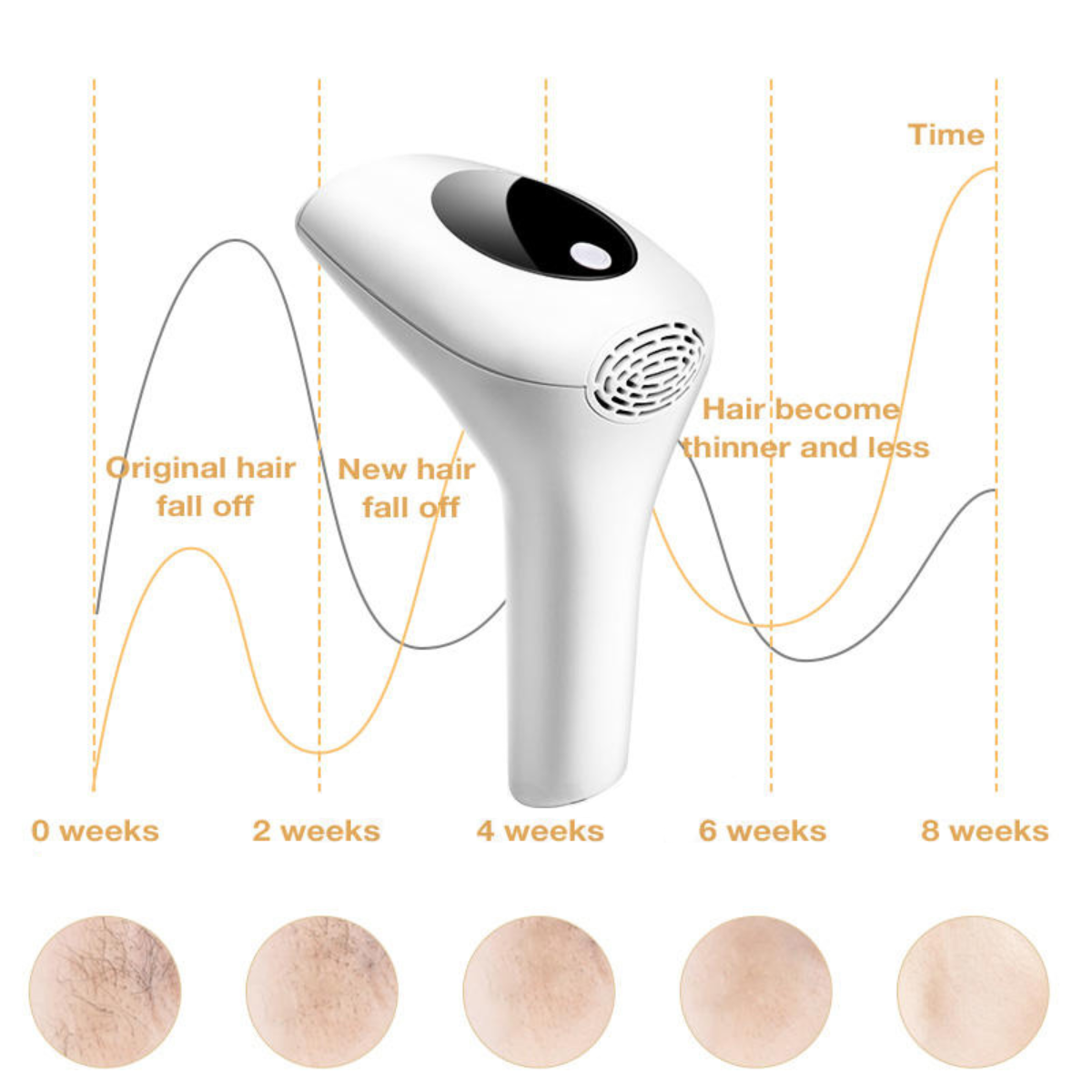 SilkyTouch Hair Removal Device