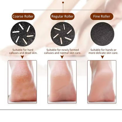 Foot Bliss Exfoliator